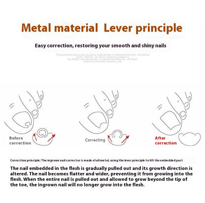 Nail Groove Embedded Nail Corrector Set Of Tools